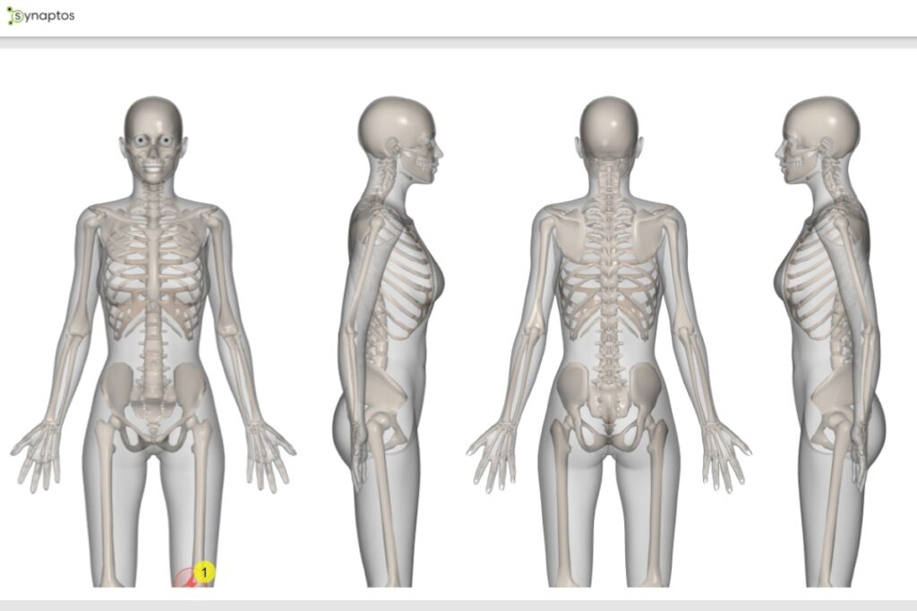 Bodychart