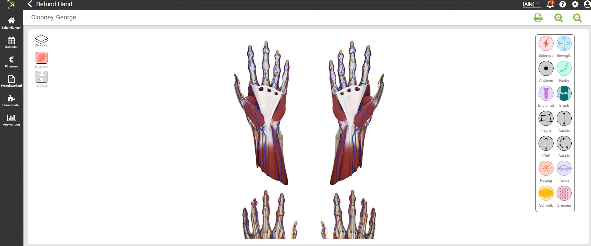 Handkarte Bodychart